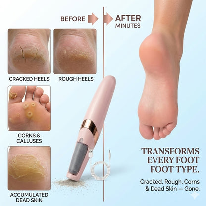 Electric Callus Remover