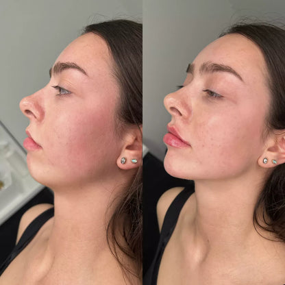 The 90-Second De-Puffer | Electric Gua Sha for Jawline Definition